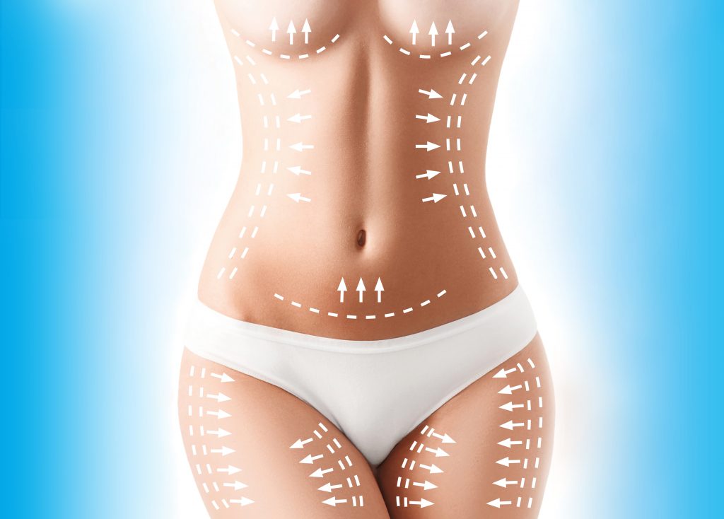 Which Is Best – SmartLipo or CoolSculpting?