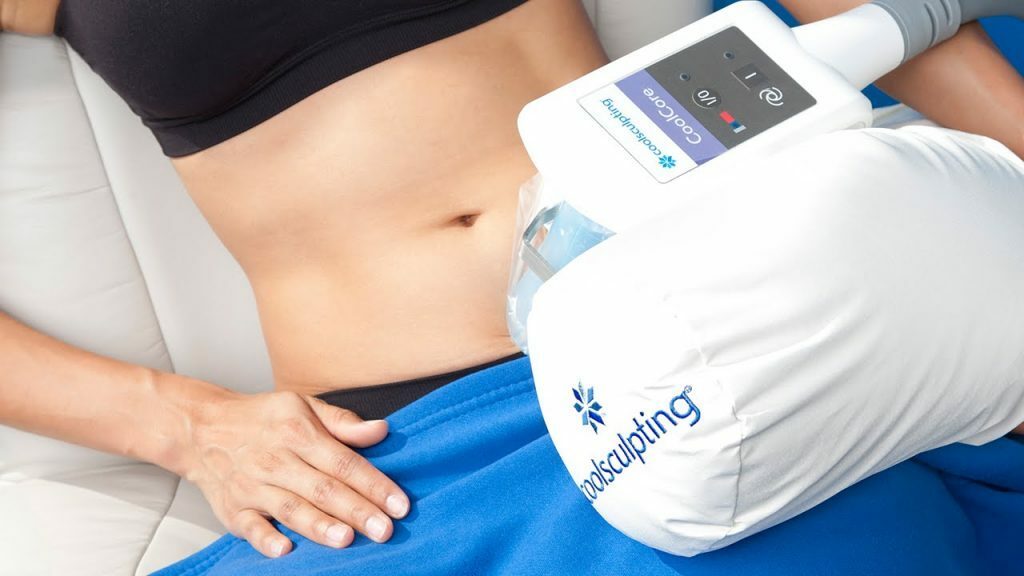 The CoolSculpting treatment freezes away fat cells without surgery.